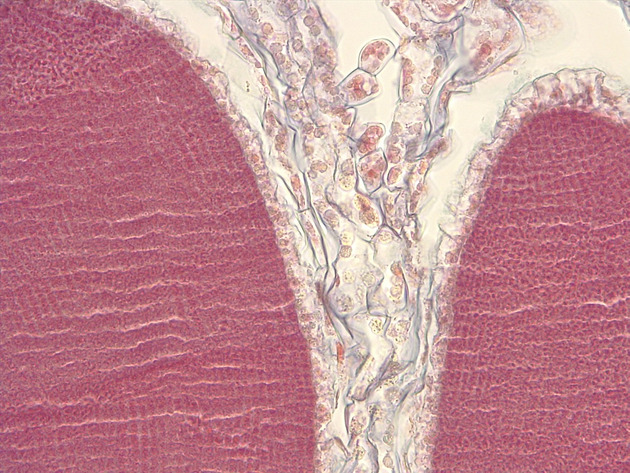 Liverwort Antheridia CS Slides - Liverwort Antheridia CS 01 400X